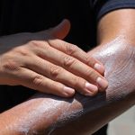 SSM emite recomendaciones para evitar daños por exposición al sol