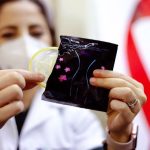 Anuncia SSM jornadas de salud sexual y reproductiva en Tingambato