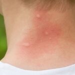 Aplica esta estrategia para evitar la reproducción del mosco transmisor del dengue