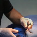Habrá jornada gratuita de vasectomía sin bisturí en Lázaro Cárdenas