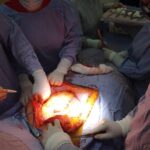 Aplica FGE protocolo para donación multiorgánica de una persona fallecida por proyectil de arma de fuego donación de órganos Zamora