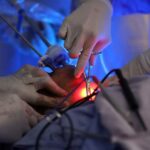 Detección temprana, clave en lucha contra el cáncer de cuello uterino: SSM