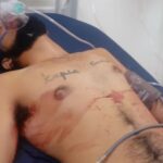 Muchacho de 22 años fue atacado a balazos por la espalda, fue llevado a un hospital y está grave, hechos en Zamora