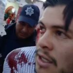 Policías municipales de Contepec, propinan golpiza a hijo de ex alcalde